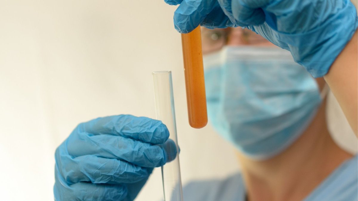 AvantiPublishe1's tweet image. Publication - JCERU

Synthesis and Characterization of Novel Nano-,Micro- and Macroporous Lignin Sorbents for Purification of Biological Fluids

Authors: NN Chopabayeva, KN Mukanov

#JCERU #Hydrolytic #lignin #macroporous  #detoxication.

Read Full Text:
doi.org/10.15377/2409-…