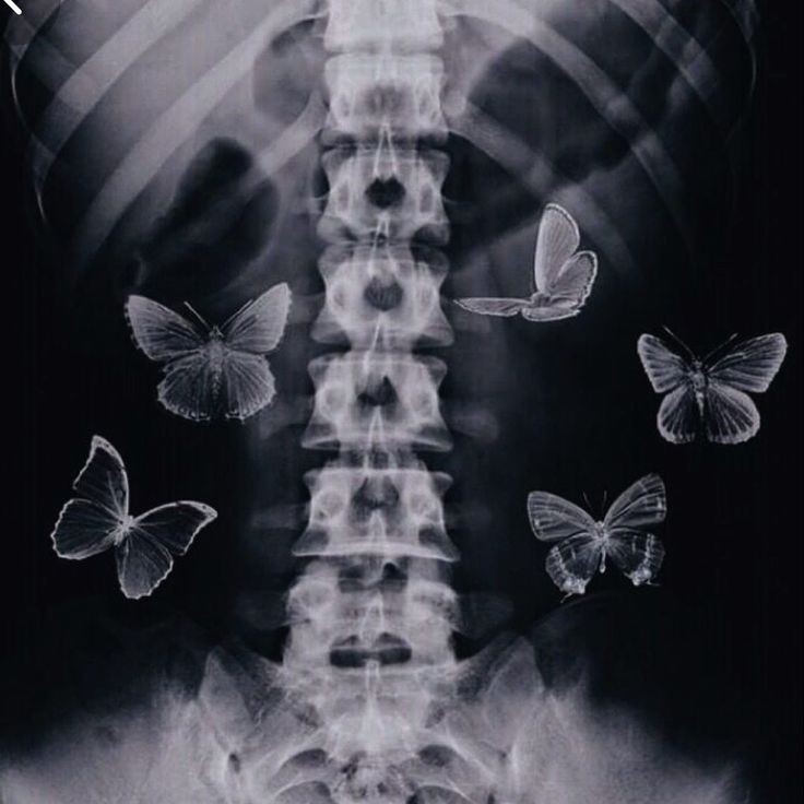 Выражение бабочки в животе