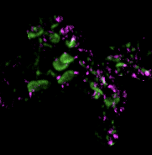 Zebrafish Rock! (@zebrafishrock) on Twitter photo Our #SpotlightZebrafish this week is on Dr. Anne Martin (@thehungrybrain), who is a #Postdoc w/ <a href="/drzebrafish/">Adam C. Miller</a> <a href="/uoregon/">University of Oregon</a>. Her project looks into the shared mechanisms of electrical and chemical synapse formation. For more, check out her recent preprint: biorxiv.org/content/10.110…. 1/2 Our #SpotlightZebrafish this week is on Dr. Anne Martin (@thehungrybrain), who is a #Postdoc w/ <a href="/drzebrafish/">Adam C. Miller</a> <a href="/uoregon/">University of Oregon</a>. Her project looks into the shared mechanisms of electrical and chemical synapse formation. For more, check out her recent preprint: biorxiv.org/content/10.110…. 1/2