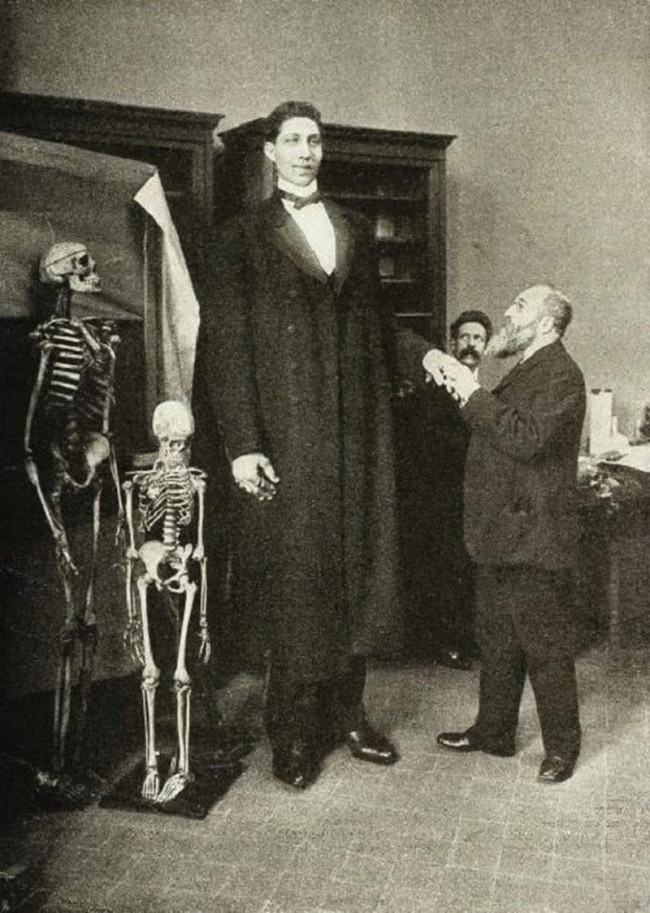 FotosDeFatos's tweet photo. Este é o maior homem da história, Fyodor Makhnov, com seus incríveis 2,85m de altura. https://t.co/VoPhN8yJ6Q