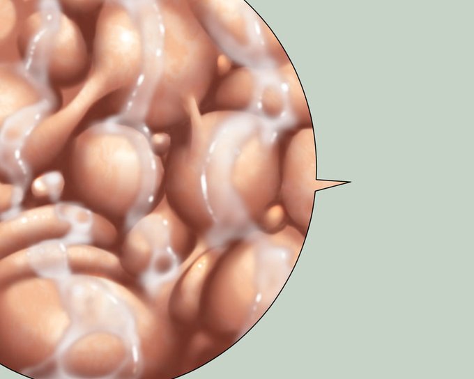 skeb:wip肉壁ちゃん
なんかマットだな 