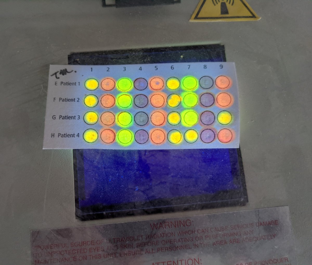 MrMaguireHJSHS's tweet photo. Check out these microarray test results! #UVflouresence #Biomedical #Innovationpathways #MedicalInterventions https://t.co/dhWpdZNnpU