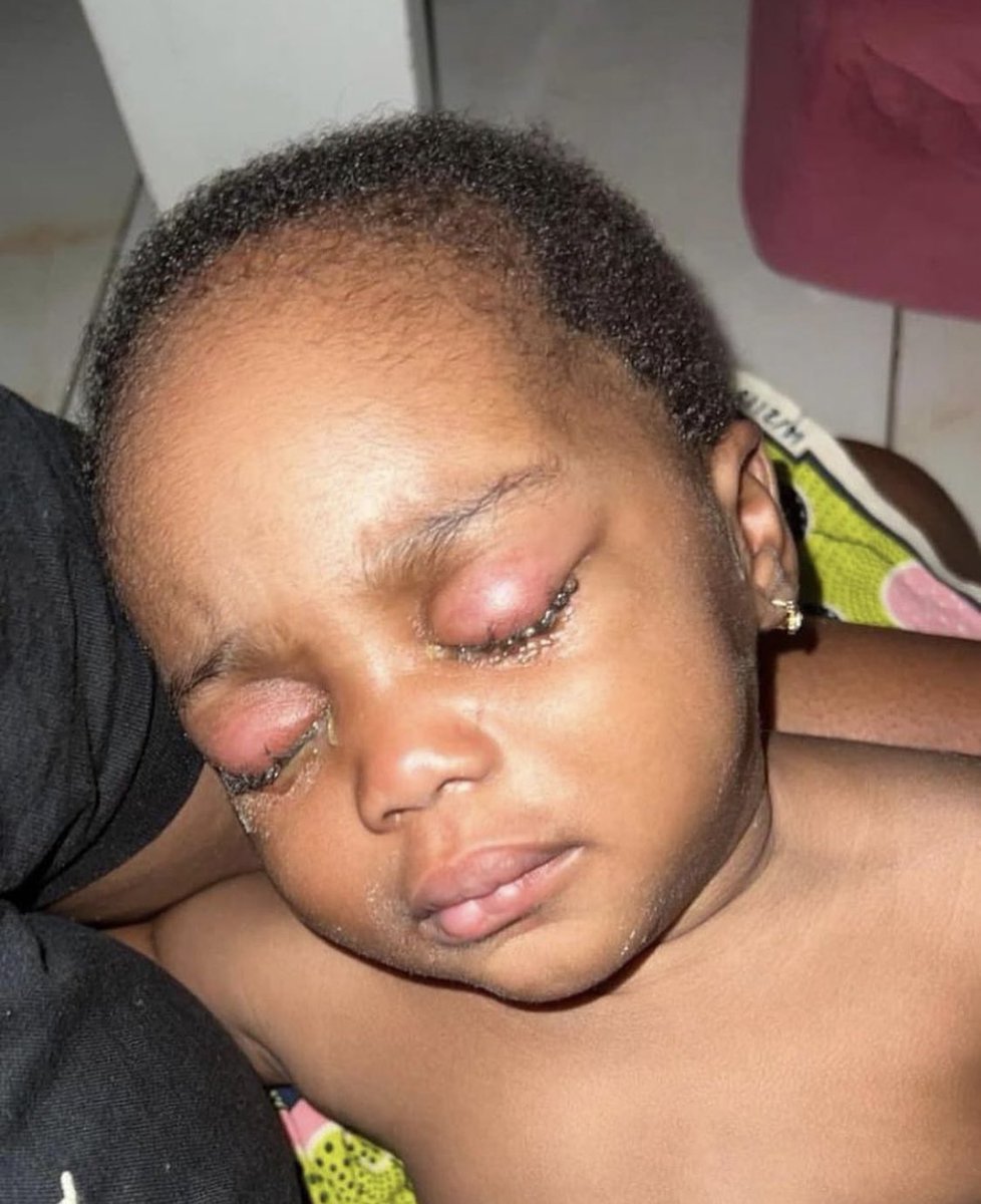 iselemramos's tweet photo. Donc là une nounou a coller les yeux d’un bébé pour qu’elle dorme je suis choqué https://t.co/FGd1hN22RK