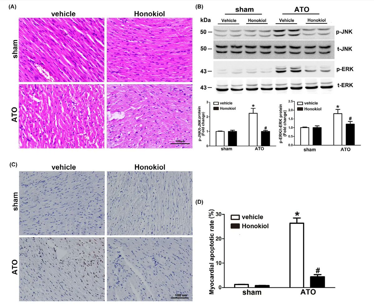 PRandP_Journal's tweet photo. #Honokiol exerts cardio-protective effects on chemical-induced cardiotoxicity. Huang et al. have shown that Honokiol alleviates the cardiotoxic effects of ATO, an effective therapeutic for acute promyelocytic leukemia. #Oncology #Pharmacology #PR_P
https://t.co/9Fv074Qbb1 https://t.co/URT3wbOhHm