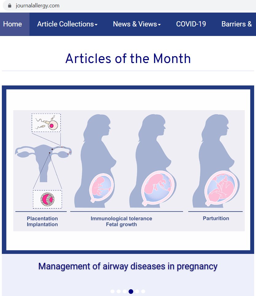AllergyEaaci's tweet photo. 📢📢Check out this month’s selection of articles by Allergy’s Editor-in-Chief, Cezmi Akdis @AkdisCezmi:

#Allergy_journal #ArticlesoftheMonth

👇👇👇 https://t.co/NmuXFAzKld