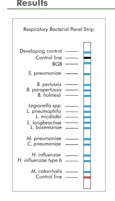 BioMedicallabs's tweet photo. Stand 704 at the #IBMSCongress2022 is where you can learn about our new test for the detection of 14 bacteria associated with respiratory tract infections #IBMSCongress2022 #bacteria #microbiology https://t.co/XQDQKpJiqJ
