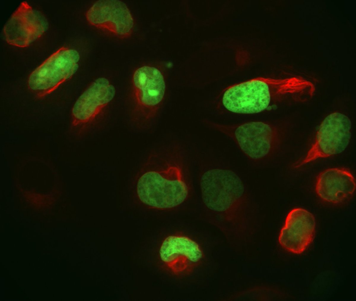 SayAlexey's tweet photo. Just another #fluorescencefriday
H2B (green)
Vimentin (red) https://t.co/xkY9OQ7X6r