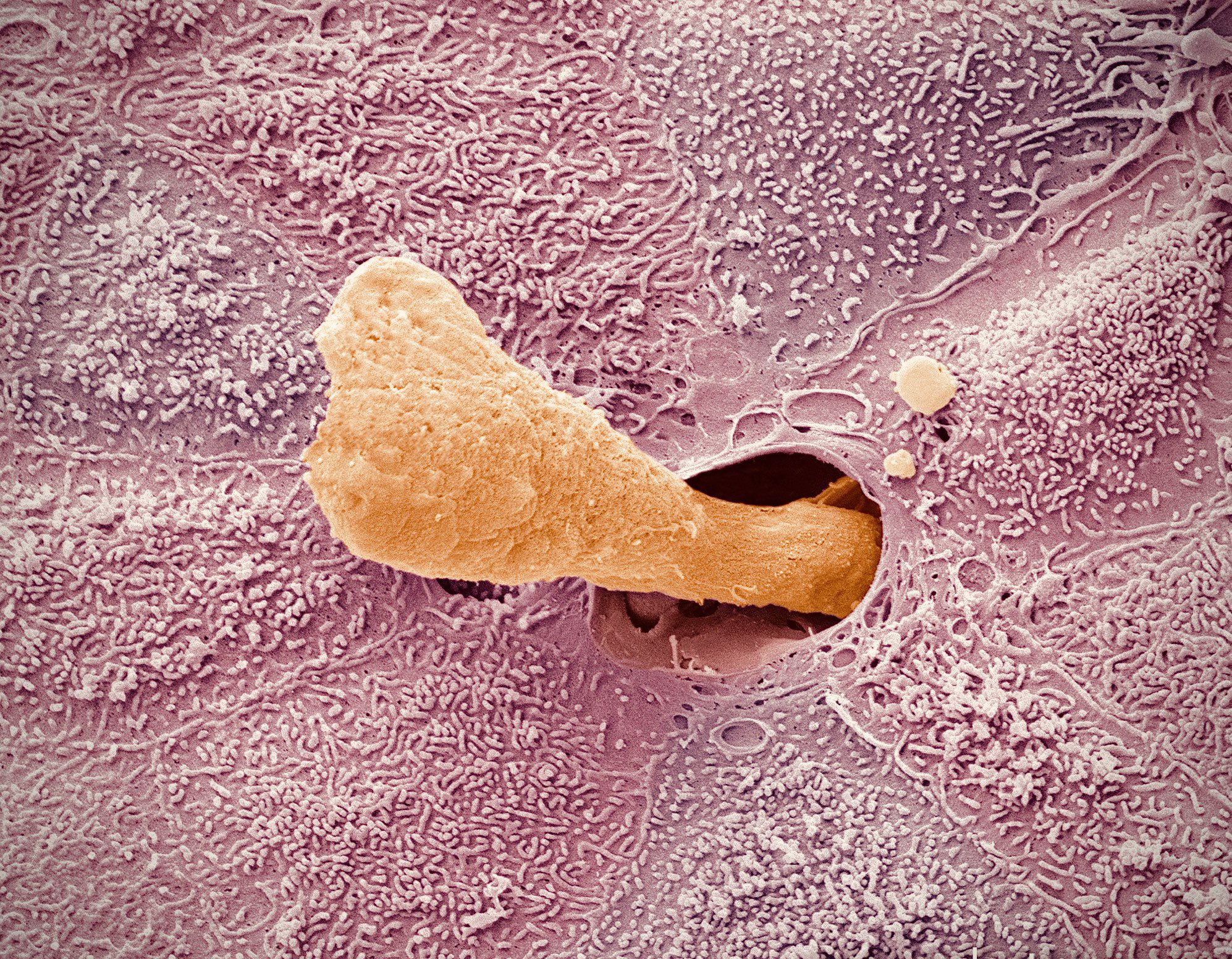 microscopic images. on Twitter "electron microscope picture of ear wax (cerumen) being secreted