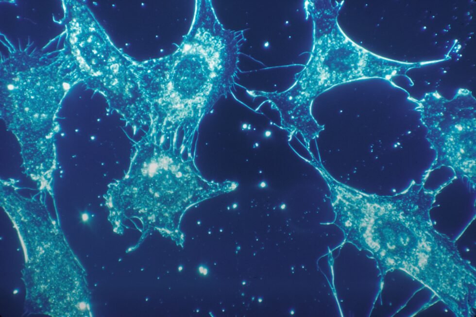 Igen_Biolab's tweet photo. #NuevoEstudio 🔬 El papel del microbioma intestinal en la génesis y prevención del cáncer 
🔗 https://t.co/gyTAvW7hoo https://t.co/b0JnlFhGnH