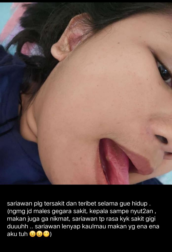 moment pertama sariawan terrrrSAKIT dan terGAKenak bikin kesel tiap ada yg ajak gue ngomong. Kzl .