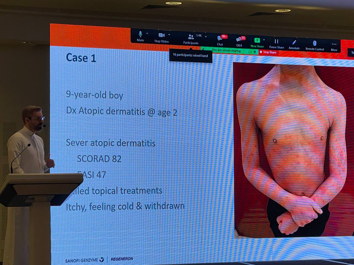 DermClub's tweet photo. 🚨 Now! “Innovations in managing pediatrics with atopic dermatitis”🤩 https://t.co/rJG3eG4HwT