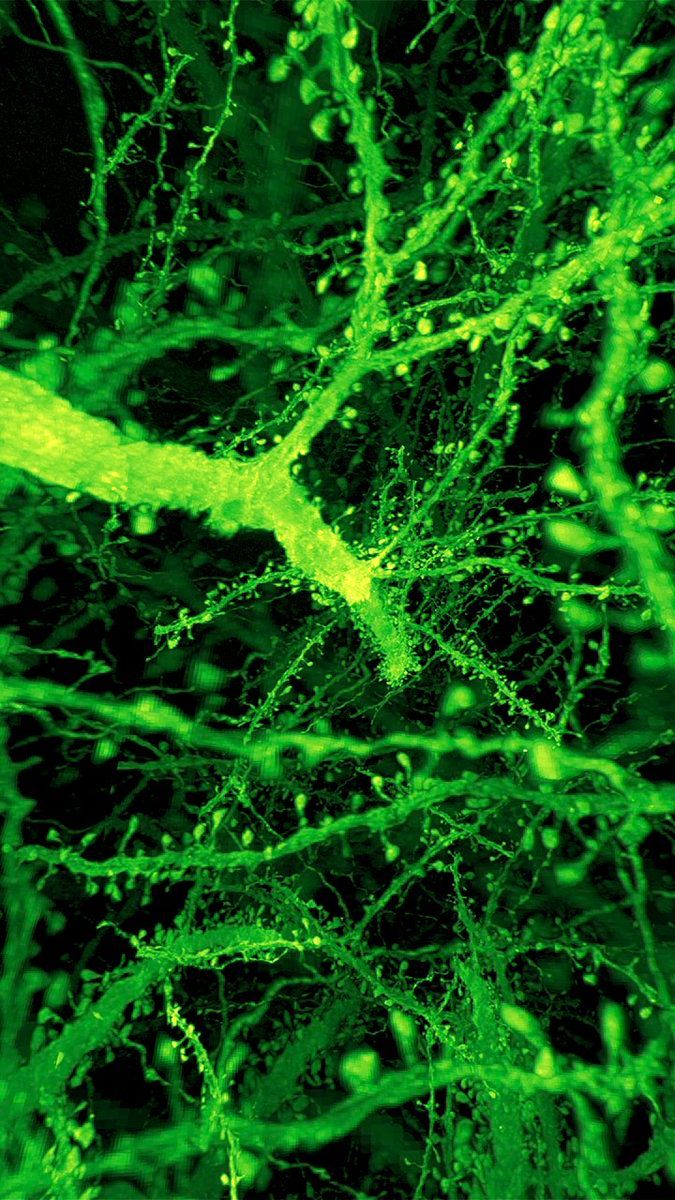 AlzResearchUK's tweet photo. A fly may be small, but its brain is incredibly useful when studying diseases like Alzheimer’s. 

Using new methods, researchers can look at these brains in exquisite detail, helping us get closer to new treatments.
@ScienceMagazine @chrost_hugo 

#ARUKImageoftheWeek https://t.co/KAF06sLLIZ