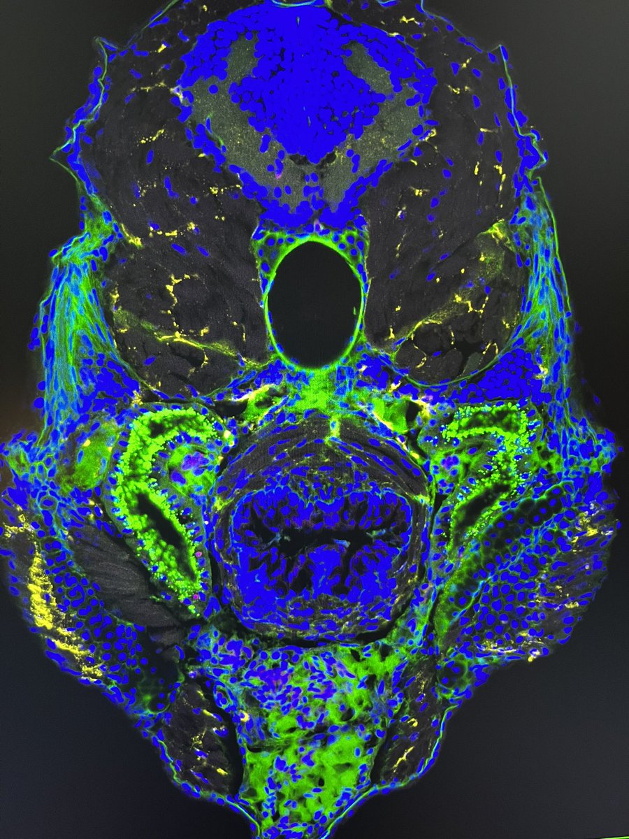 Siegerist's tweet image. Happy #FluorescenceFriday. This week Mathieu from @VirginieLecaude Lab visited us to learn how to screen #zebrafish for proteinuria. Here a cryosection of a proteinuric larva w/ vitamin-D-binding-protein-eGFP accumulation in proximal tubules. onlinelibrary.wiley.com/doi/10.1111/ap…