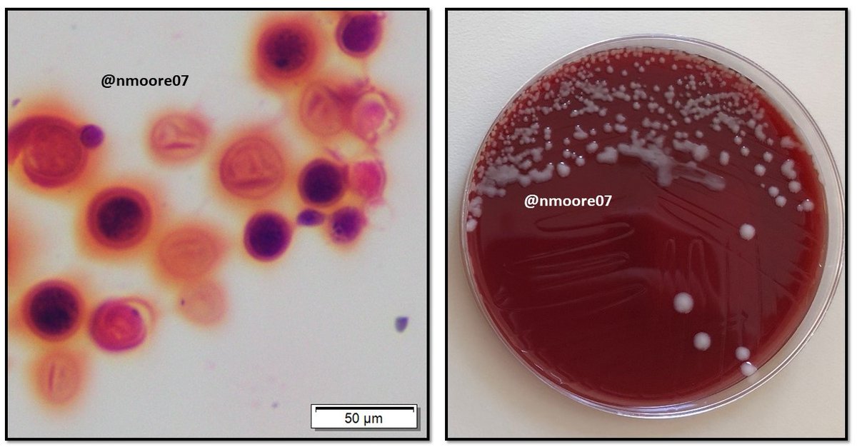 #MicroRounds Day 91: Happy #FungalFriday with this Gram stain and colonies of large, round, encapsulated yeast from a positive blood culture. #cryptococcosis #IDtwitter #medtwitter #ASMClinMicro