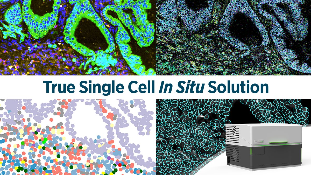 brukerspatial's tweet image. What can you do with data from 800,000 single cells? See the power of CosMx Spatial Molecular Imager and engage with our FFPE data-set on Non-small cell lung cancer. 

bit.ly/379eMAH

#SingleCellImaging #SpatialMultiomics #SpatialTranscriptomics