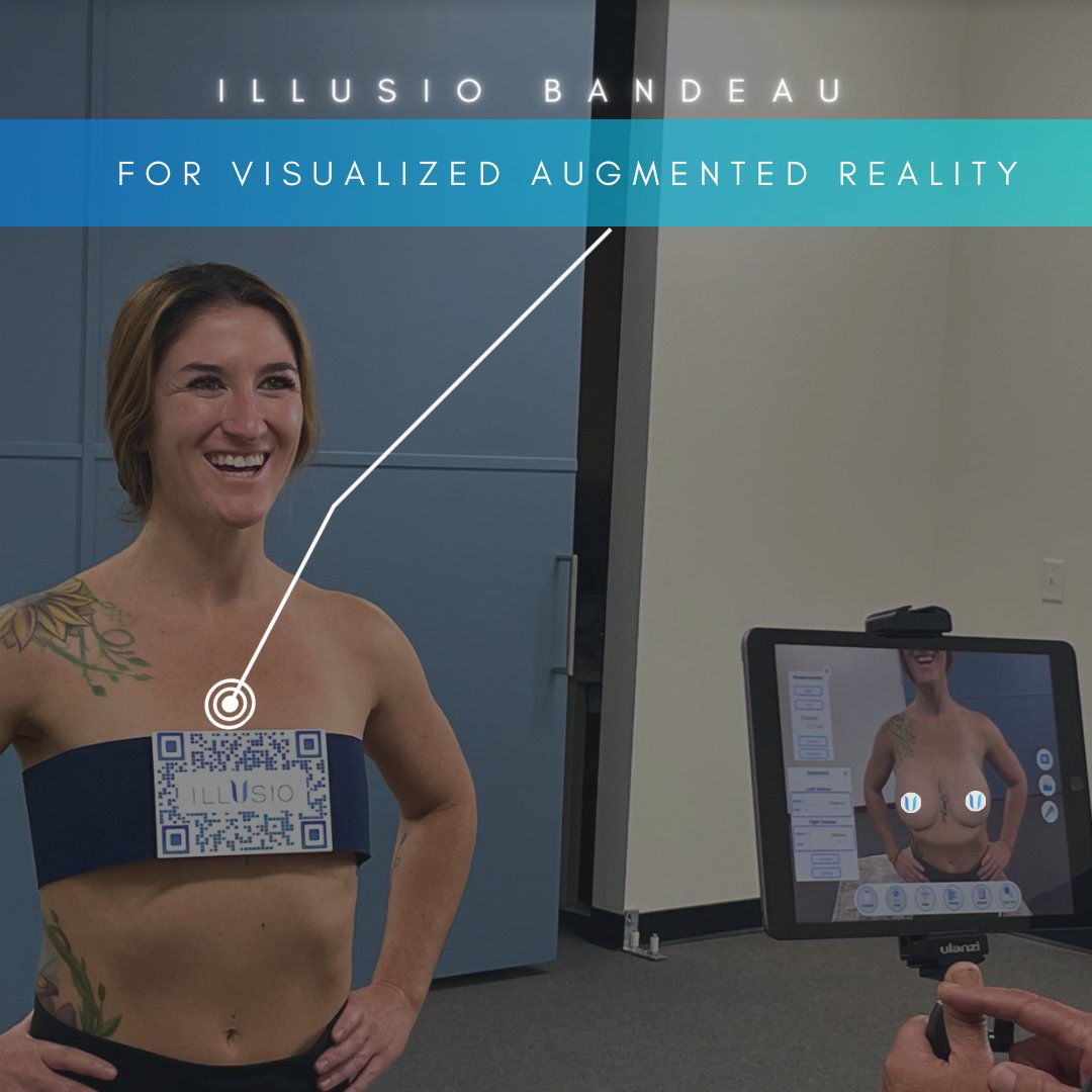 IllusioImaging's tweet photo. With our virtual mirror, surgeons can now show their patients what they can look like post-op and properly manage their expectations. 📈

Check out our website to learn more: https://t.co/Wy8tfJTTcU https://t.co/sSkke8FCIF