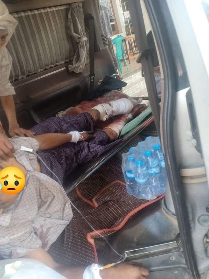 spring_2021's tweet photo. On Mar7,KoHtwe was hit by a landmine planted by SAC on the way to forest near NwarBangGyi village,Ywangan Tsp,Danu Autonomous Region,S.Shan State and suffered serious injuries to his lower body.Then,UKyinAg,a resident of Myauk Village was shot dead on Mar12.

#2022Mar12Coup https://t.co/Q08a6XCThC