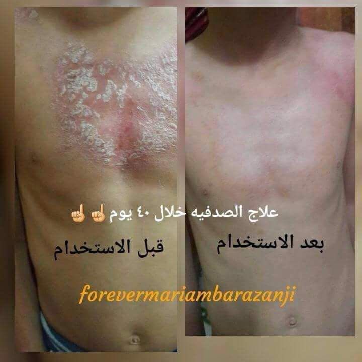 العناية بالصحة والجمال For Care tweet media