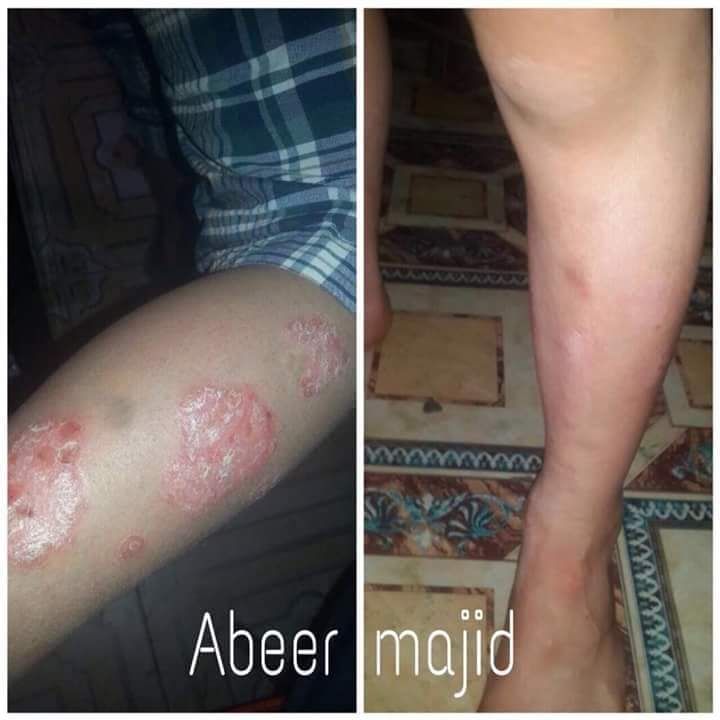 العناية بالصحة والجمال For Care tweet media