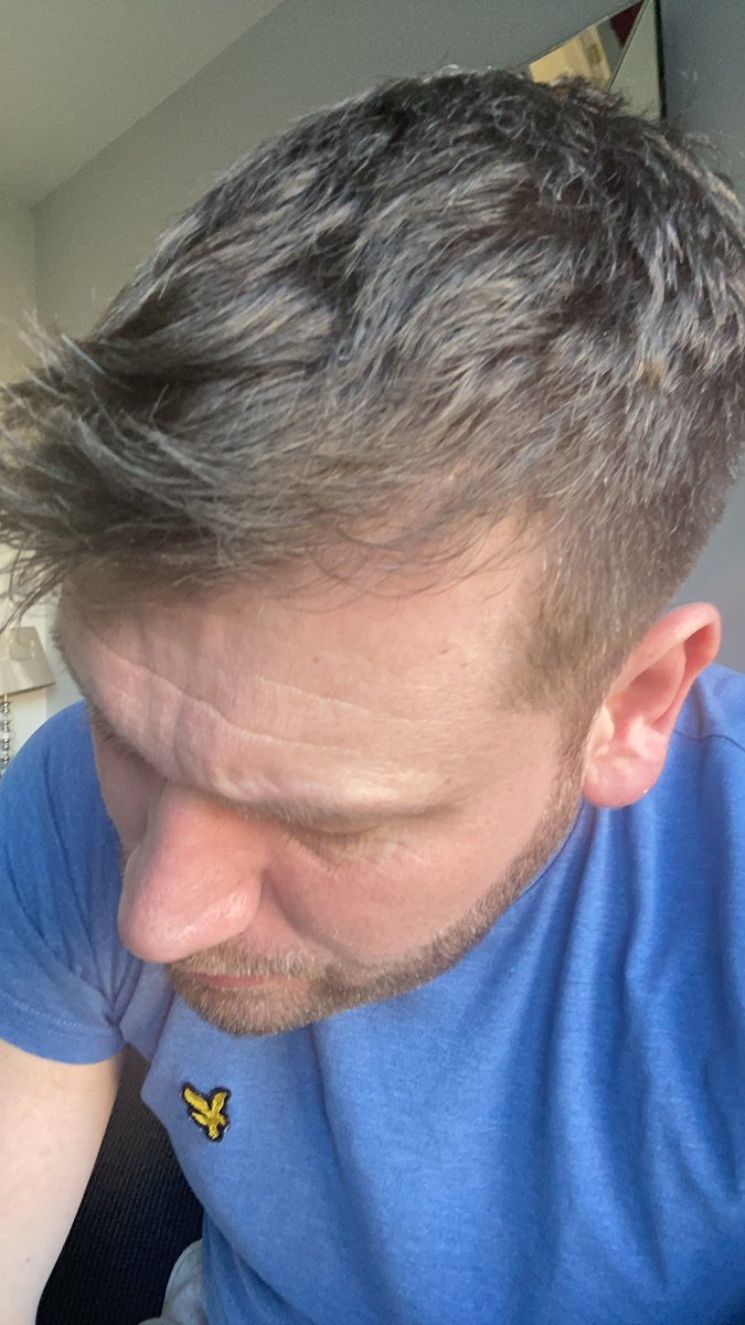 Garethbowz's tweet photo. @ExtraMcExtra2 @81flibbertigibb Been to Turkey #fullhead https://t.co/LFvculuFyR