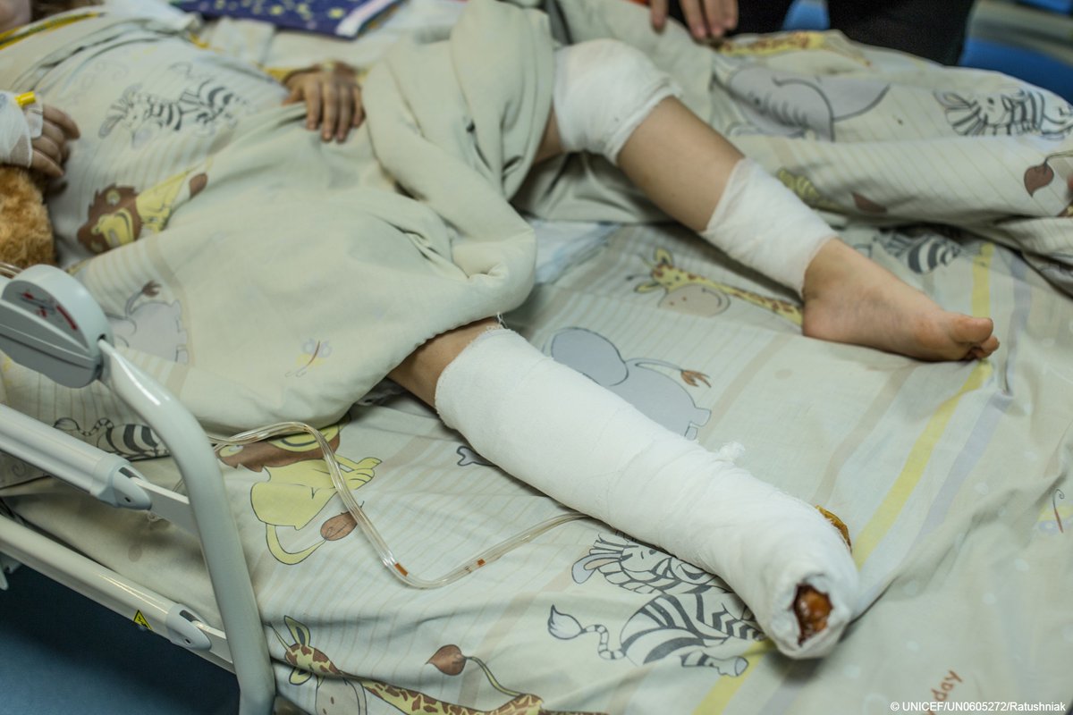 UNICEF's tweet photo. Shelling killed six-year-old Milana's mother. She's now recovering after surgery at a children's hospital in Kyiv, #Ukraine.

Her wounds will heal, but the death of her mother will scar her for a lifetime. 

Children need peace now. https://t.co/SHttmVeVgo