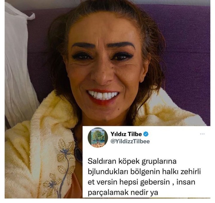 #SokakHayvanlarıSahipsizDeğil <a href="/YildizzTilbee/">Yıldız Tilbe</a> vebalini nasıl ödeyeceksin ölen hayvanların ÖZÜR DİLE