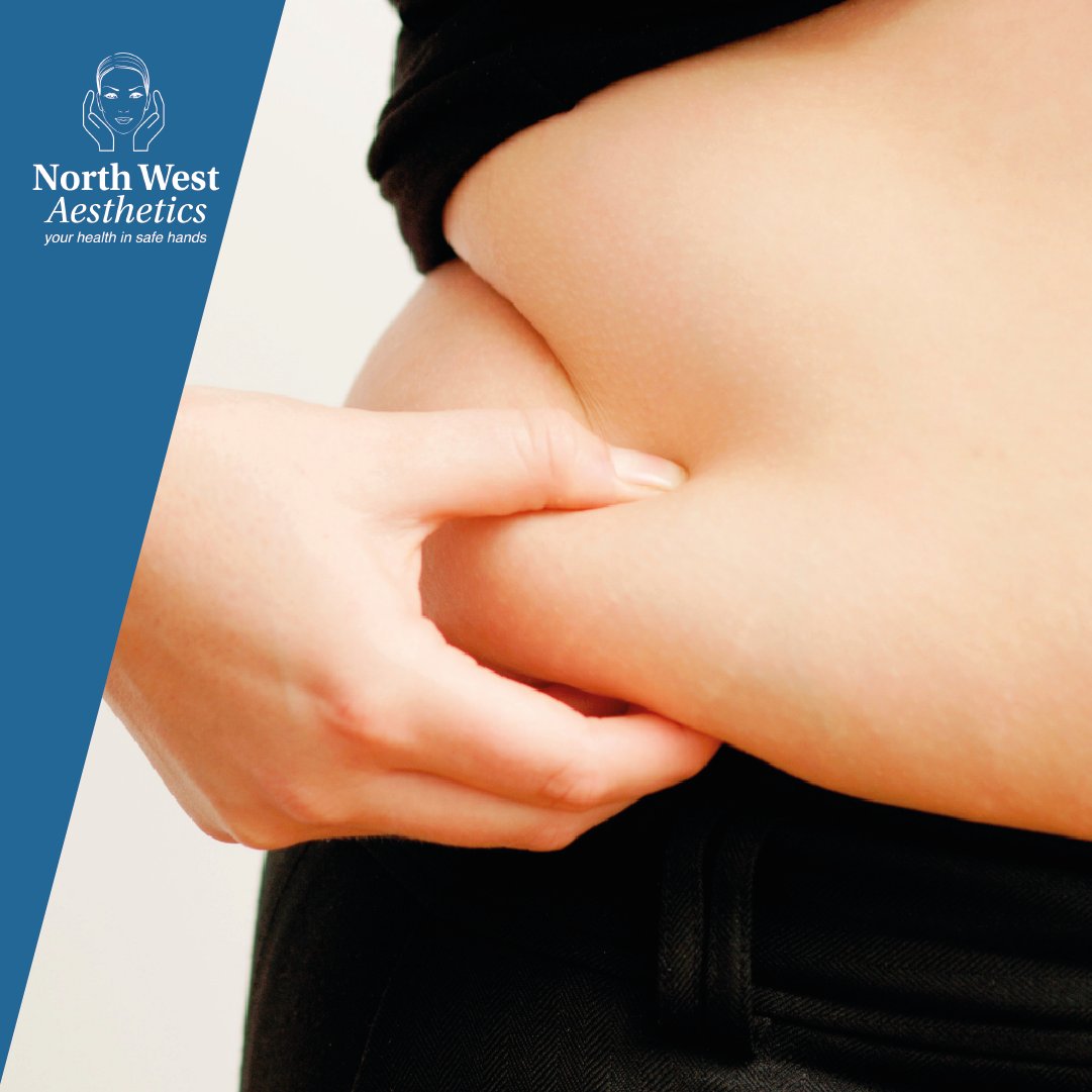 Not in love with your #LoveHandles? #Aqualyx #fat dissolving injections help to reduce your #waistline with no downtime! Treatments start at £199. Call #NorthWestAesthetics to schedule your appointment.