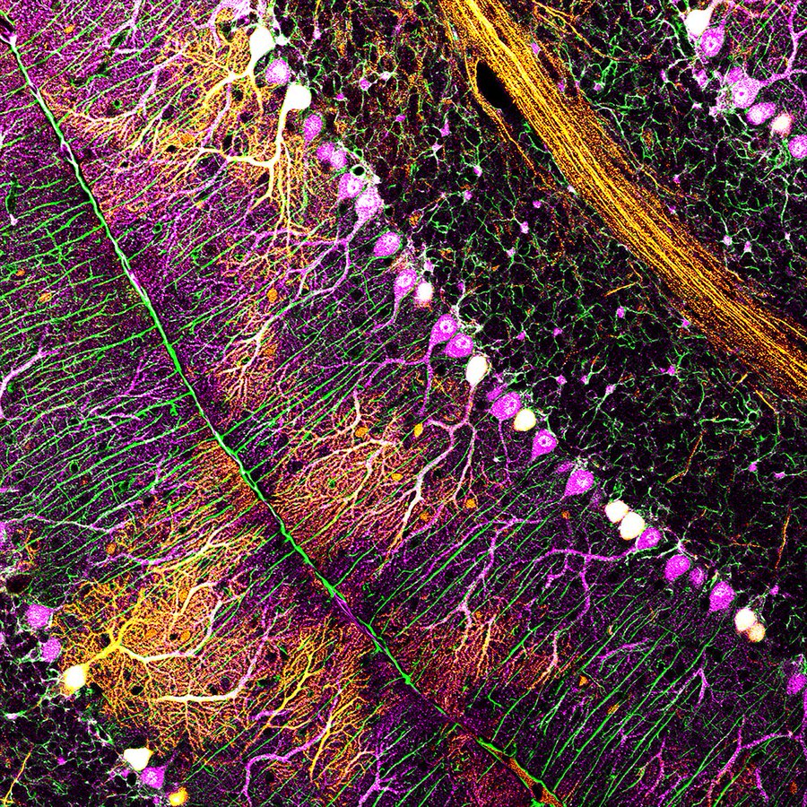 Network of brain cells in the cerebellum:

#neuroscience by Giuseppe Gangarossa