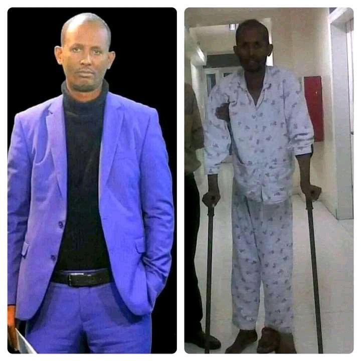 abdisaoromia's tweet photo. Walked in to prison as a healthy man and came out being almost unrecognizable. The cost of being a freedom fighter in Ethiopia under dictator Abiy Ahmed will cost you. This will pass too among other things. I wish you a speedy recovery Jaal Battee Urgeessaa
#WB0 #Jajjabee https://t.co/MR9rvTy4fX