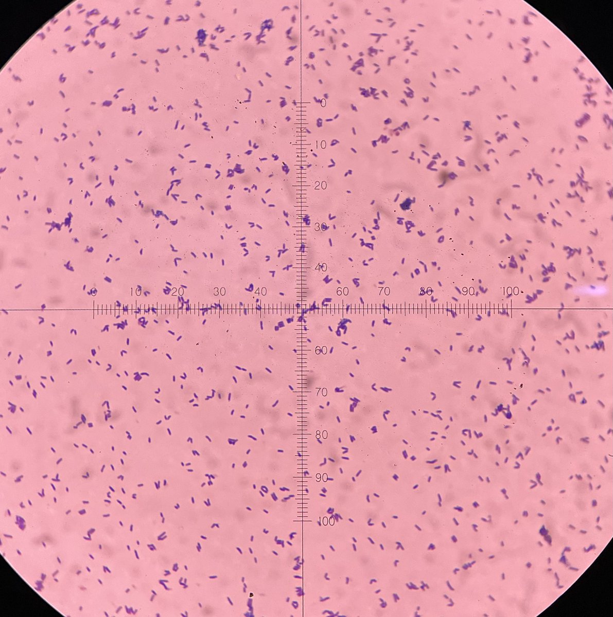 philipellorin_'s tweet photo. CORYNEBACTERIUM

PALISADE ARRANGEMENT OF CELLS
(X OR Y CONFIGURATION)
@MedtechMustKnow
@medtech_journal https://t.co/I6kwjXzGdp