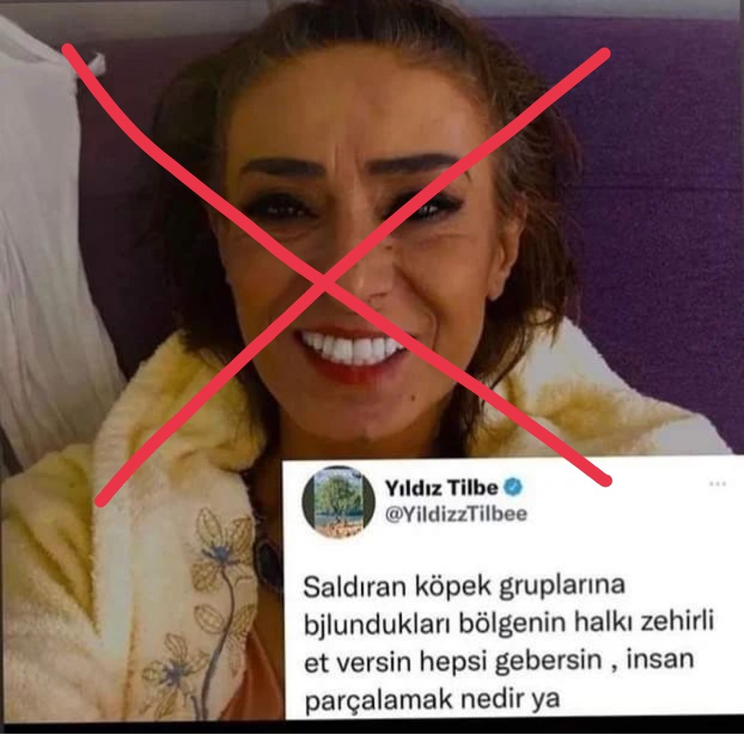 Bundan böyle asla dinlemem!!  #YildizTilbe #yıldıztilbeboykot