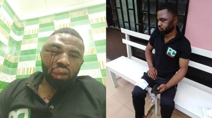 mimimefo's tweet photo. The attack on journalist Paul Chouta has really left me worried about his personal security and life.
After what happened to #Wazizi, I cannot understand why #Chouta has not received any protection
Any independent and critical journalist remains in danger under the #Biya regime https://t.co/T8S9IkaWkK