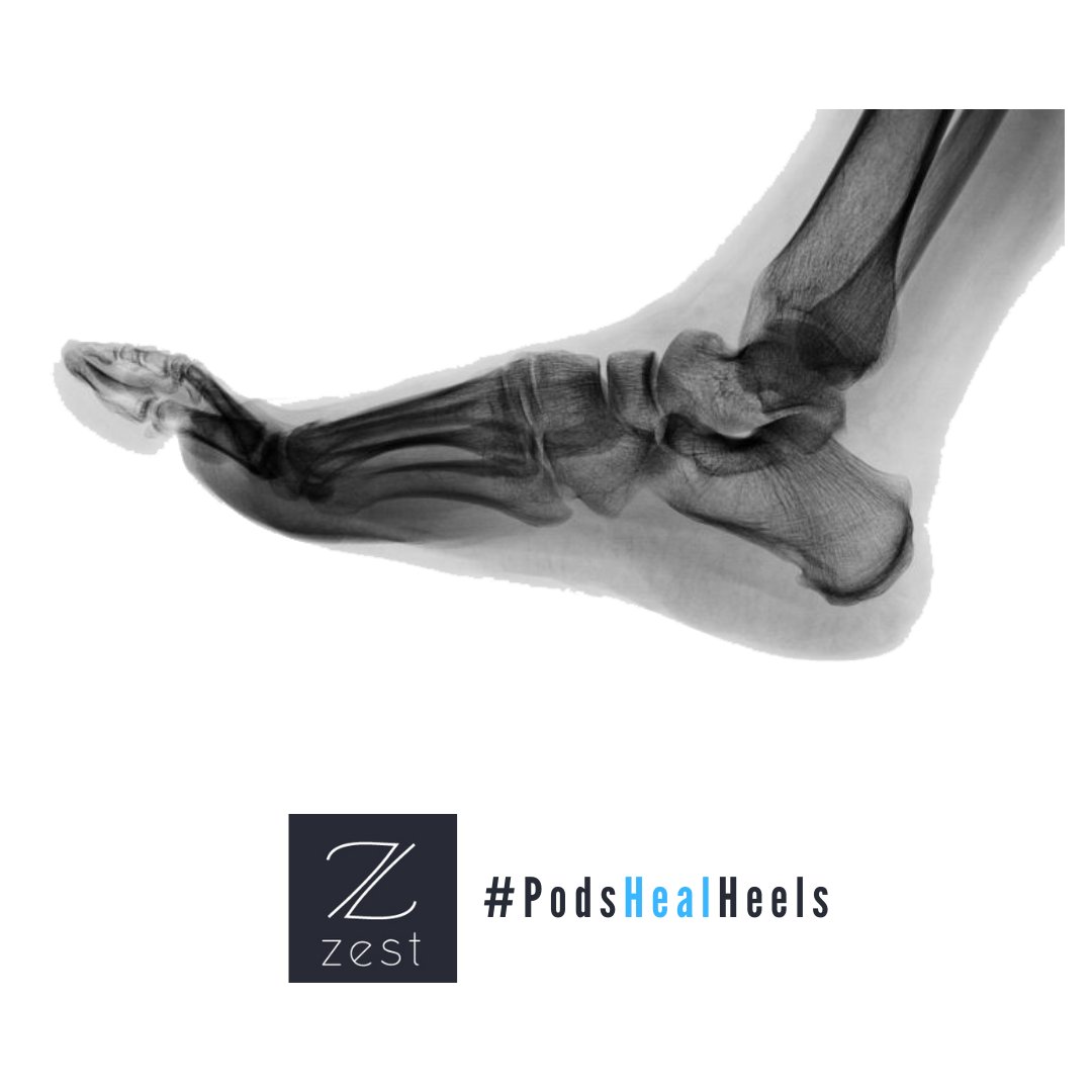 zestAHP's tweet photo. The foot - An x-ray produces images of the structures inside your body, particularly your bones.

More Info:https://t.co/fzCTqvVx0O

#zestahp #oxford #podiatry #podshealheels #thefoot https://t.co/DeR8lcWISR