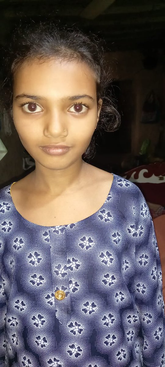 Amarsimgh3's tweet photo. सोशल मीडिया दोस्तों से मेरी एक रिक्वेस्ट है इस बच्ची का नाम ब्यूटी है और यह तो घर से लापता है मेरे सभी सोशल मीडिया के दोस्तों से इसे ढूंढने में हमारी मदद करें

संपर्क करें इस नंबर पर 9510577906 🙏

@WeUttarPradesh @Zeenewshindi24 @ANI @News18UP @SpecialCoverage @SudarshanNewsTV https://t.co/upx1FTLSfC