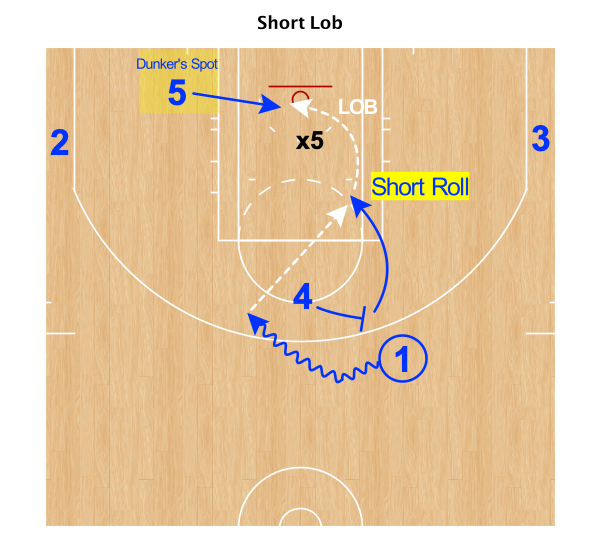 RadiusAthletics's tweet photo. Short Roll and Short Lob #ModernBigTips https://t.co/EgwfCY4IEW