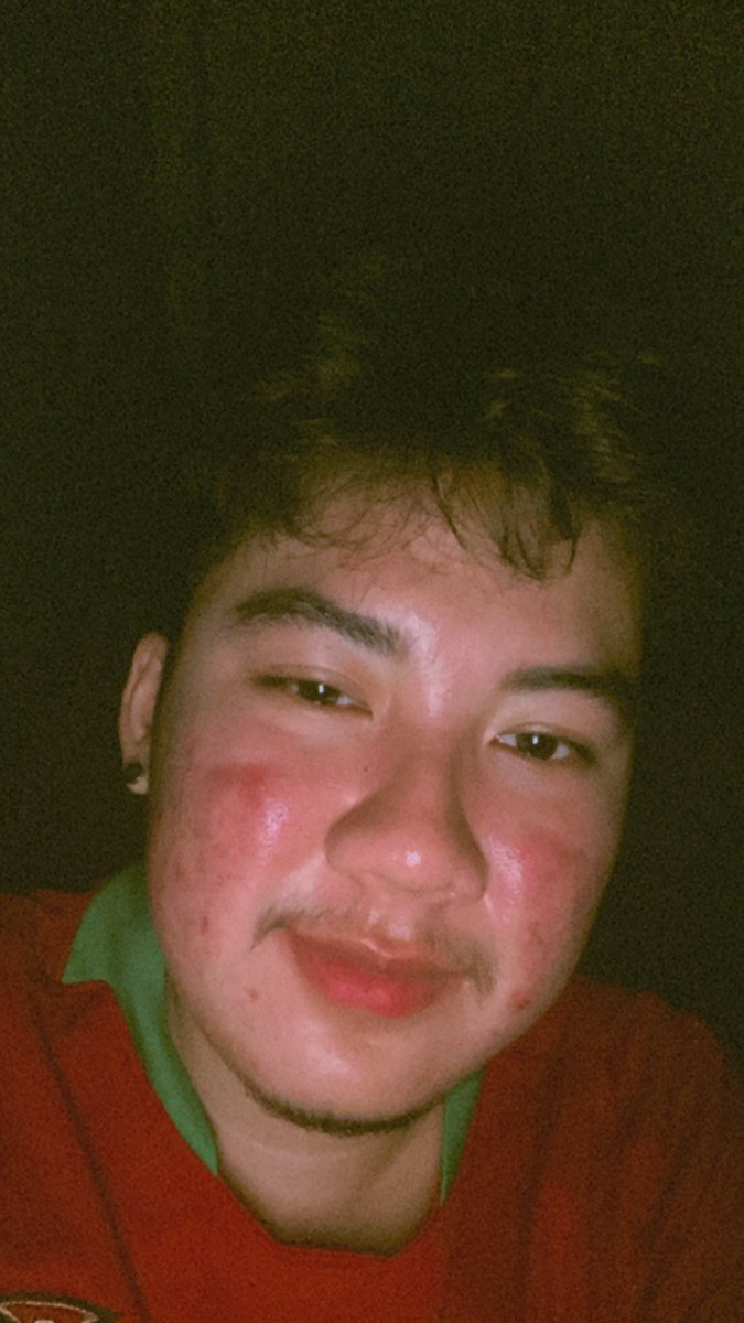 Sukan065's tweet photo. เป็นสิวจนหน้าแดง 😂 #ทรานส์แมน #FTM #trangender https://t.co/hkQ4w9tfjl