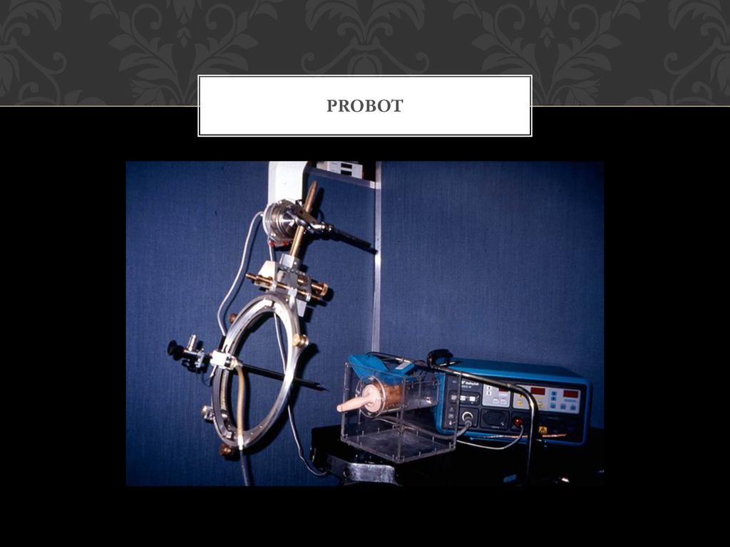British urologist John Wickham (1927-2017) was a pioneer in minimally invasive surgery (a term he coined in 1986), and invented the ‘probot’, a surgical robot used for transurethral resection of the prostate. This was first used on a patient in April, 1991.