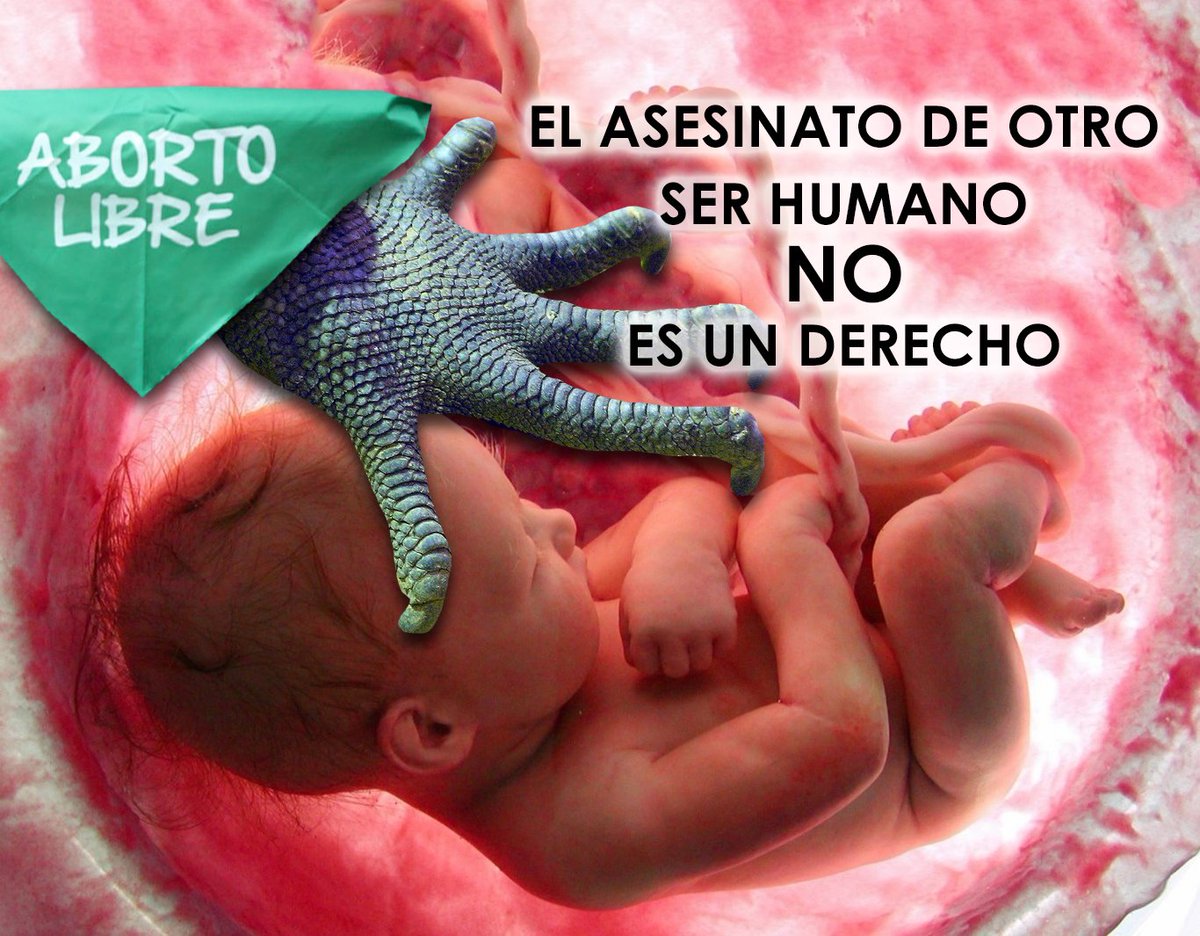 NorwalkCurtis's tweet photo. #LeyAbortistaNO #DileSiAlaVida
#VetoPorLaVida #NoAlAborto https://t.co/hlQyYHAwXy