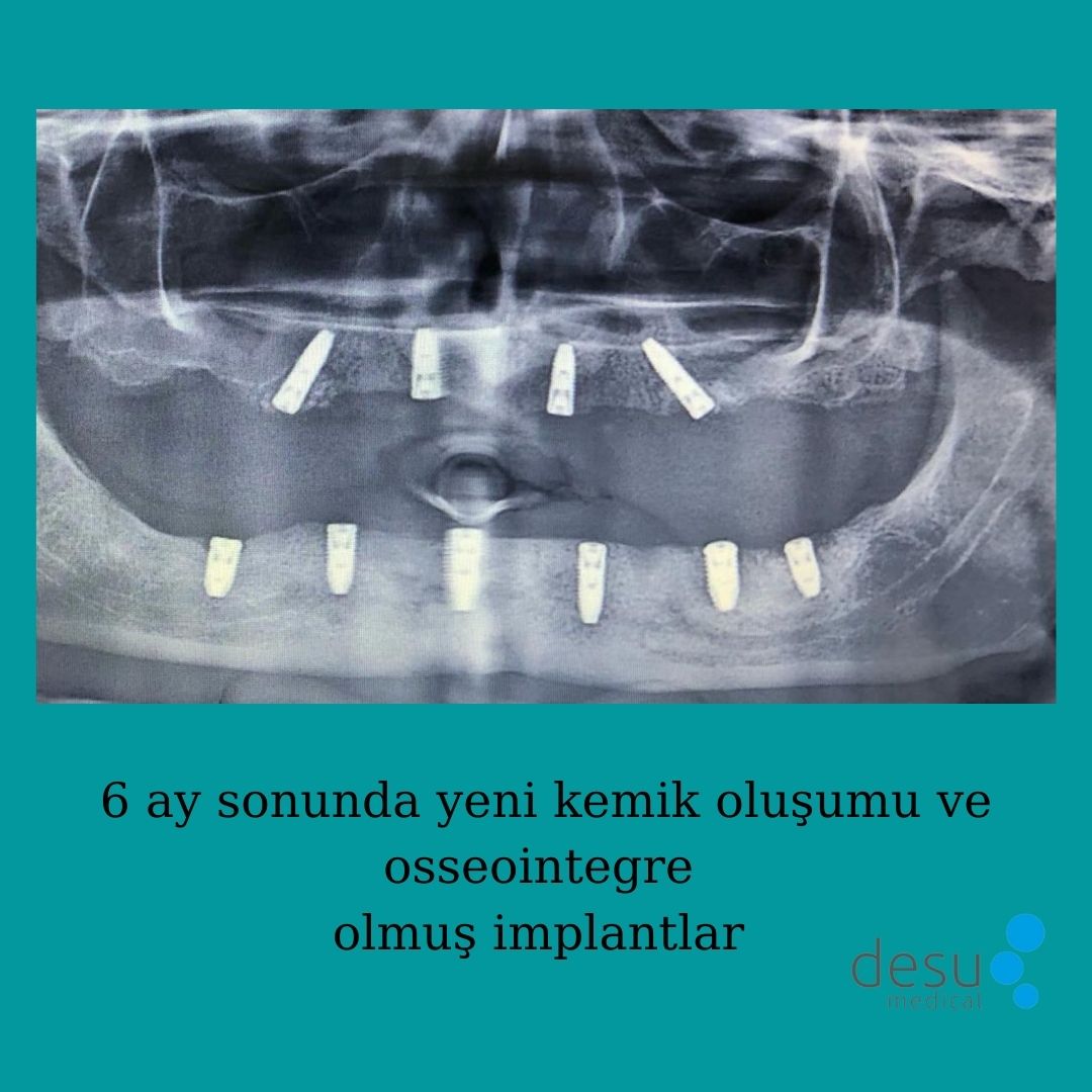 desu_dental (@desudental) / Posts / X