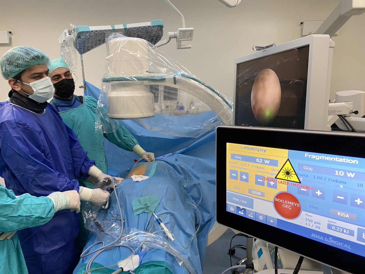erenerol (@erenerl_) on Twitter photo Dusting during miniperc with a game-changing high power laser, my third-year residency in @meramurology <a href="/IlqarDr/">Ilqar Mikayilzade</a> <a href="/ofc_dr/">Dr.OmerFarukCavdar</a> <a href="/guven_selcuk/">Selçuk Güven</a> Dusting during miniperc with a game-changing high power laser, my third-year residency in @meramurology <a href="/IlqarDr/">Ilqar Mikayilzade</a> <a href="/ofc_dr/">Dr.OmerFarukCavdar</a> <a href="/guven_selcuk/">Selçuk Güven</a>