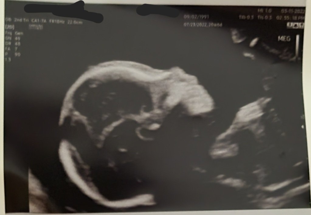 spacekaydet's tweet photo. Feeling someone wiggle around inside you is by far the weirdest part of pregnancy 🤣 but happy to have you here 
#babyboy #21weeks #uterusacrobat https://t.co/CYQ8BnPh16