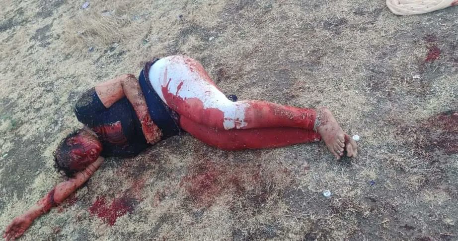 DefenceEra's tweet photo. A man named Mohammad Ijaz in Karnataka's Gadag brutally stabbed his wife Apoorva Puranik, alias Arfa Bhanu, for seeking divorce after finding out that he was already married &amp; a father of 3 children.
Currently, she's fighting for her life in a hospital. Her condition is critical https://t.co/04BKOoNjOo