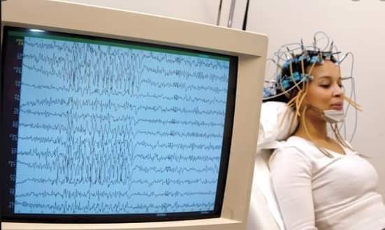 EA_Neuroscience's tweet photo. Our Sunday epilepsy clinic at Kisii Galaxy Medicare centre is active and dedicated to offer its best in discharging its service. We offer consultation and investigation (EEG) https://t.co/Nelhrc4xiR
