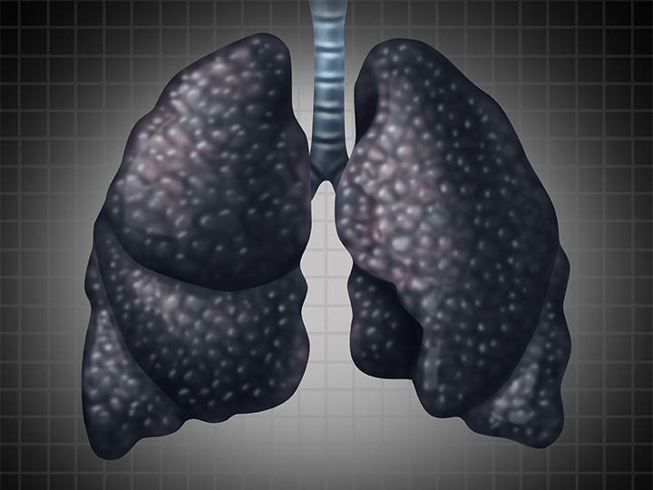 My lungs after smoking that Coach K AND Joe Lunardi pack