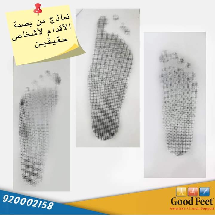 #القدم_المسطحة تزيد من فرص  الإصابة بآلام فى الكعب والتهاب أربطة القدم بالإضافة لمشاكل الركبة واسفل الظهر المرتبطة بهبوط فى اقواس القدمين !
يوصي الأطباء باستخدام دعامات تصحيحية للتحكم فى الألم والإصابة المرتبطة بالقدم المسطحة .
#عظام #علاج_طبيعي #حذاء_طبي #حذاء_مريح #حذاءرياضي