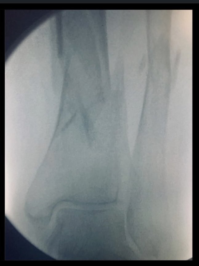 Naan Derthaal, DO, FAAOS tweet media