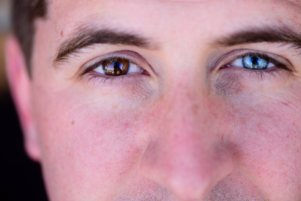 NovovisionEsp's tweet photo. Cuando cada ojo es de un color: ¿Qué es la heterocromía? ¿Deben preocuparse quienes la tengan? https://t.co/Vo3q7ZhN6b https://t.co/fwFDZF2ybb