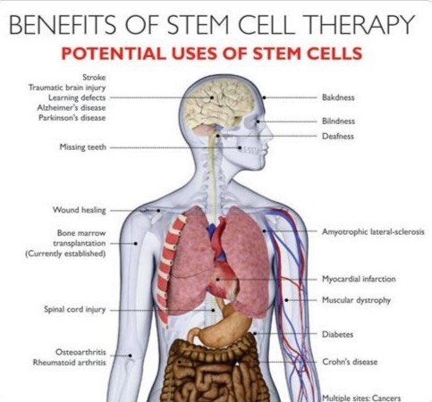 Epochal_Cell's tweet photo. Understanding Stem Cell Therapy https://t.co/kCNZdhHpbK
