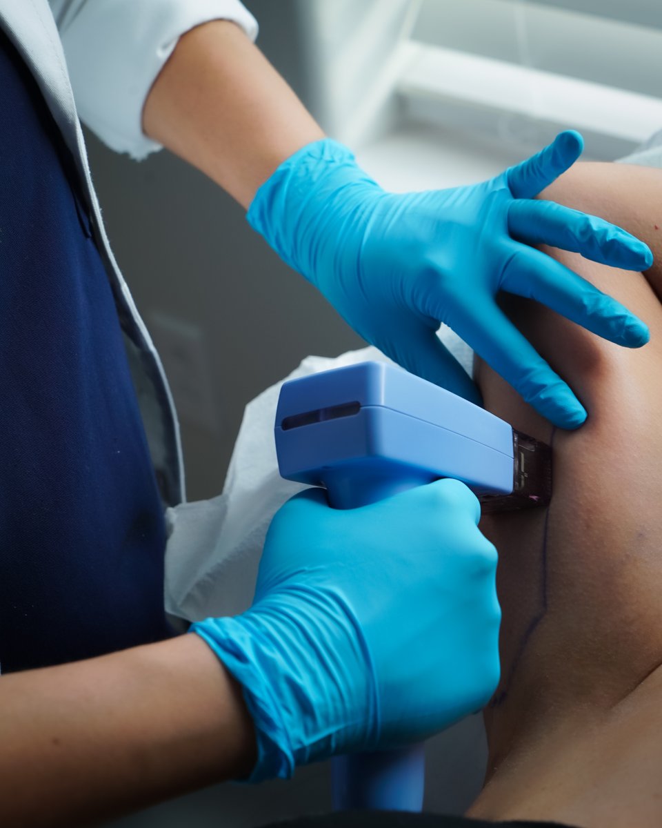 wwhfrisco's tweet photo. #Morpheus8 works through microneedling and radio frequency. The needles promote collagen production and the radio frequency remodels fat tissue in the deeper layers of the skin. Simple concept. Outstanding results.

#WWHFrisco #FriscoMedSpa #Microneedling #nonsurgicalfacelift https://t.co/54d3ZQbbJI