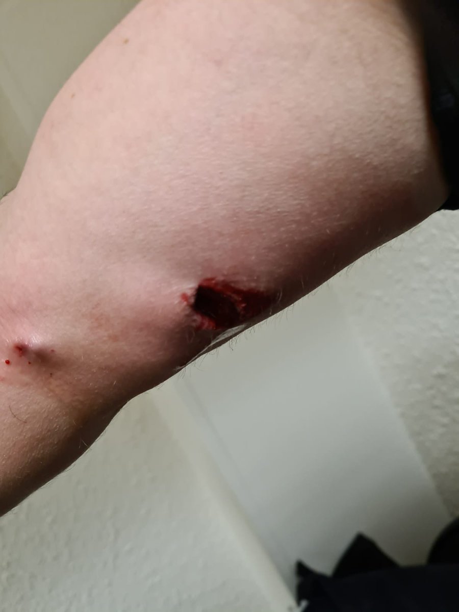 CRSUNSAPolice's tweet photo. Bastia: manifestation qui dégénère.
De nombreux blessés du côté des CRS dont 1 suite à un mortier qui percute une munition.
Soutien total aux collègues engagés, la soirée risque d'être longue. https://t.co/s9phEFf8EC